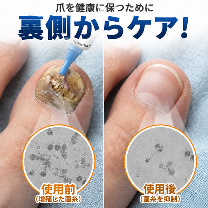 🇯🇵 Trilumia® Fungi Free ビーベノム ネイルトリートメント 🥼 – わずか7日で目に見える変化を実感