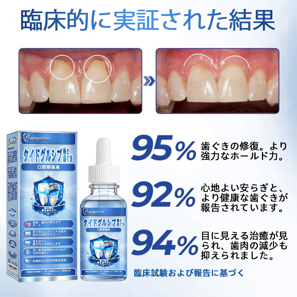 𝑮𝒂𝒓𝒂𝒈𝒆𝑳𝒊𝒏𝒆® 𝑻𝒊𝒅𝒆𝒈𝒍𝒖𝒔𝒊𝒃 歯と歯ぐきの修復ソリューション🌴🧪