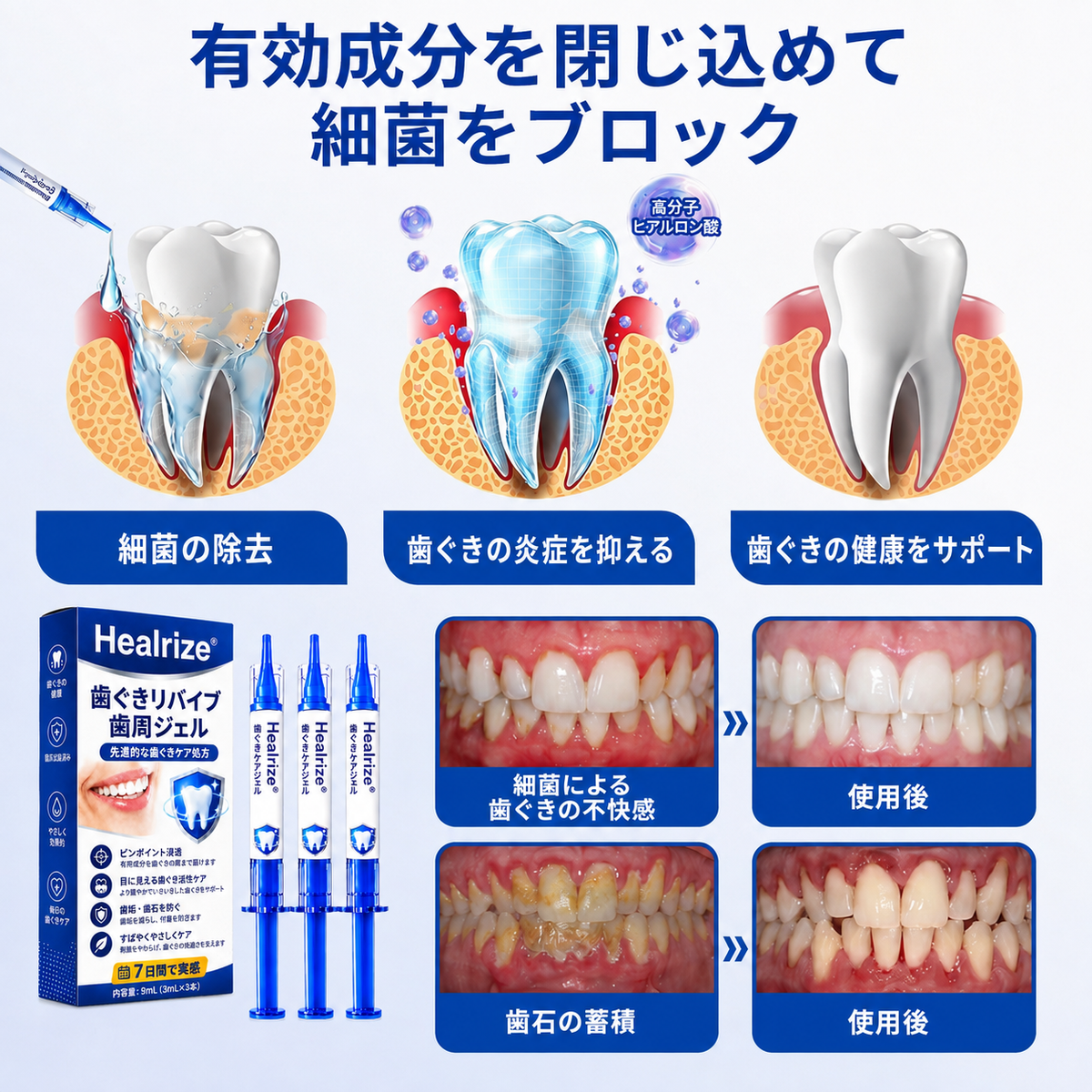 ✨Healrize® ガムリバイブ 歯ぐきケアジェル（歯ぐきからの出血、歯ぐき下がり、歯のぐらつきが気になる方へ）